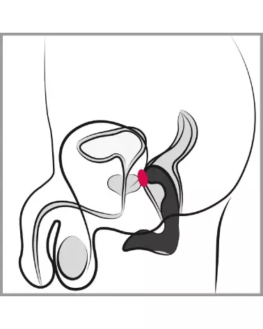 Rebel Prostate Plug rechargeable pour stimulation prostatique efficace-7